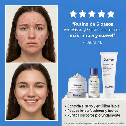 Tratamiento Completo™ | Control Inteligente del Sebo y Brotes Recurrentes